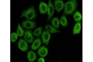 Immunocytochemistry staining of HeLa cells fixed with 4 % Paraformaldehyde and using anti-pyruvate dehydrogenase (lipoamide) alpha 1 mouse mAb(dilution 1:100). (PDHA1 antibody)