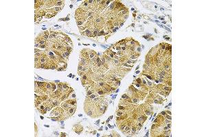 Immunohistochemistry of paraffin-embedded Human stomach using TrkA antibody (ABIN7268895) at dilution of 1:100 (40x lens). (TRKA antibody  (C-Term))