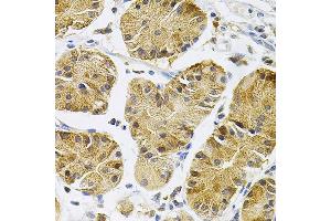 Immunohistochemistry of paraffin-embedded Human stomach using TrkA antibody (ABIN7268895) at dilution of 1:100 (40x lens).