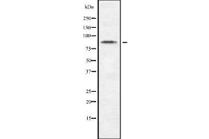 Western blot analysis of CDH10 using Jurkat whole cell lysates (CDH10 antibody  (C-Term))