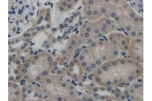 Detection of TGFb1 in Mouse Kidney Tissue using Polyclonal Antibody to Transforming Growth Factor Beta 1 (TGFb1) (TGFB1 antibody  (AA 279-390))