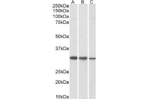 Western Blotting (WB) image for anti-Capping Protein (Actin Filament) Muscle Z-Line, beta (CAPZB) antibody (ABIN5907201)