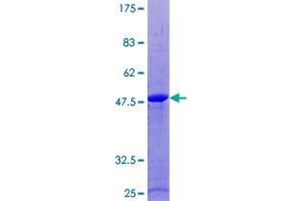 RAB18 Protein (AA 1-206) (GST tag)