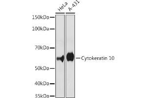 Western blot analysis of extracts of various cell lines, using Cytokeratin 10 antibody (ABIN1679404, ABIN3019133, ABIN3019134 and ABIN7101721) at 1:500 dilution. (Keratin 10 antibody)