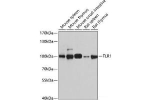 Western blot analysis of extracts of various cell lines using TLR1 Polyclonal Antibody at dilution of 1:1000. (TLR1 antibody)