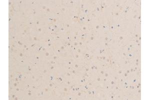 ABIN6267244 at 1/100 staining mouse brain tissue sections by IHC-P. (MITF antibody  (pSer73, pSer180))