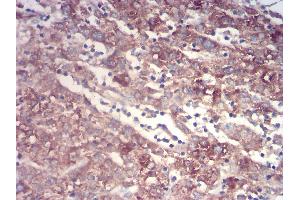 Immunohistochemistry (IHC) image for anti-Transthyretin (TTR) (AA 1-147) antibody (ABIN5875576) (TTR antibody  (AA 1-147))