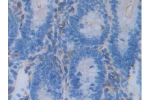 DAB staining on IHC-P; Samples: Rat Intestine Tissue (Acrosin antibody  (AA 43-291))