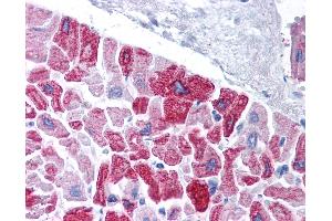 Anti-KCNH5 / Kv10. (KCNH5 antibody  (AA 156-205))