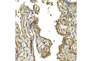 Immunohistochemistry (IHC) image for anti-Interferon Induced with Helicase C Domain 1 (IFIH1) (AA 1-205) antibody (ABIN6142174)