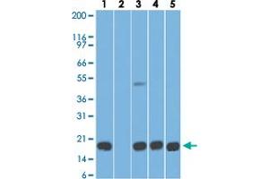 Western blot analysis of Lane 1: human stomach tissue lysate in the absence of immunizing peptide, Lane 2: human stomach tissue lysate in the presence of immunizing peptide, Lane 3: mouse stomach tissue lysate, Lane 4: rat stomach tissue lysate and Lane 5: HCT-116 cell lysate with AGR2 monoclonal antibody, clone IMG10E2  at 5 ug/mL working concentration. (AGR2 antibody  (AA 50-100))