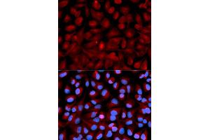 Immunofluorescence analysis of U2OS cells using HD antibody (ABIN6128056, ABIN6141683, ABIN6141686 and ABIN6215208). (HDAC6 antibody  (AA 160-470))