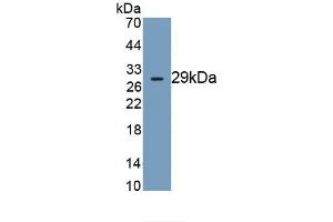 Detection of Recombinant DNAH11, Human using Monoclonal Antibody to Dynein, Axonemal, Heavy Chain 11 (DNAH11) (DNAH11 antibody  (AA 3896-4122))