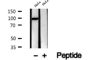 Western blot analysis of extracts of HeLa cells, using VPS16 antibody. (VPS16 antibody  (Internal Region))