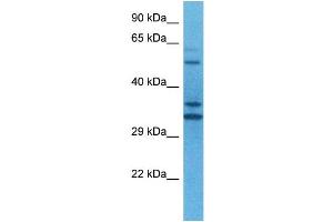 Host:  Rabbit  Target Name:  TEAD2  Sample Tissue:  Human U937 Whole Cell  Antibody Dilution:  1ug/ml (TEAD2 antibody  (N-Term))