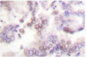 Image no. 1 for anti-Cyclin-Dependent Kinase Inhibitor 2B (p15, Inhibits CDK4) (CDKN2B) antibody (ABIN271760) (CDKN2B antibody)