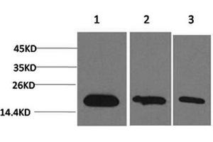 Western Blotting (WB) image for anti-Baculoviral IAP Repeat-Containing 5 (BIRC5) antibody (ABIN5958344) (Survivin antibody)