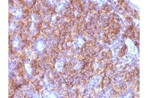 Formalin-fixed, paraffin-embedded parathyroid stained with Chromogranin A antibody (CGA/413 + CHGA/777 + CHGA/798) (Chromogranin A antibody)