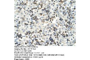 Rabbit Anti-HSD17B6 Antibody  Paraffin Embedded Tissue: Human Liver Cellular Data: Hemopoietic Antibody Concentration: 4. (HSD17B6 antibody  (N-Term))