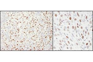 anti-Minichromosome Maintenance Deficient 4 (MCM4) (AA 750-800) antibody