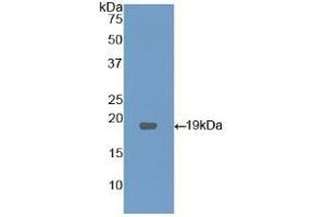 Detection of Recombinant LPCAT3, Human using Polyclonal Antibody to Lysophosphatidylcholine Acyltransferase 3 (LPCAT3) (LPCAT3 antibody  (AA 122-233))