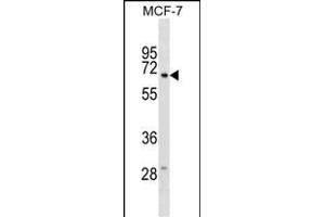 GGT6 Antibody (N-term) (ABIN1539190 and ABIN2849091) western blot analysis in MCF-7 cell line lysates (35 μg/lane). (gGT6 antibody  (N-Term))