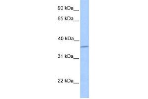 WB Suggested Anti-LAYN Antibody Titration: 0. (Layilin antibody  (N-Term))