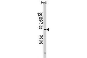 Western blot analysis of CD4 polyclonal antibody  in HeLa cell line lysates (35 ug/lane). (CD4 antibody  (AA 58-86))