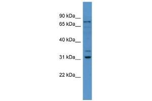 Fbxo34 antibody used at 0. (FBXO34 antibody  (N-Term))