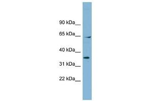 RanGAP1 antibody used at 1 ug/ml to detect target protein. (RANGAP1 antibody  (N-Term))