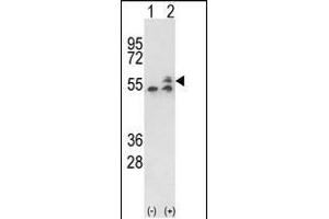 Western blot analysis of ATP5B (arrow) using rabbit polyclonal ATP5B Antibody (Center) (ABIN650786 and ABIN2839558). (ATP5B antibody  (AA 135-163))