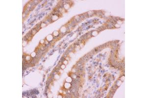 Immunohistochemistry (IHC) image for anti-Nuclear Factor of kappa Light Polypeptide Gene Enhancer in B-Cells 2 (NFKB2) (AA 1-340) antibody (ABIN3043293)
