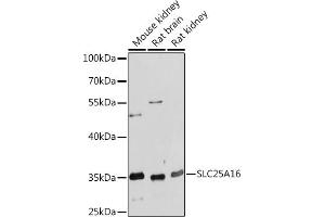 Western blot analysis of extracts of various cell lines, using SLC25 Rabbit pAb (ABIN7270432) at 1:1000 dilution. (SLC25A16 antibody  (AA 200-300))