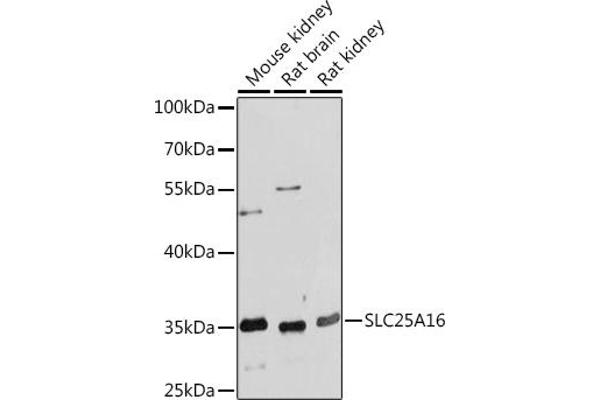 SLC25A16 Antikörper  (AA 200-300)