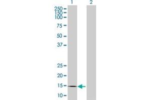 Western Blot analysis of CREBL2 expression in transfected 293T cell line by CREBL2 MaxPab polyclonal antibody. (CREBL2 antibody  (AA 1-120))