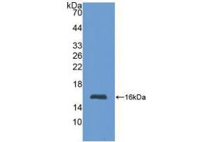 Western blot analysis of recombinant Human MT1. (MT1 antibody  (AA 1-61))