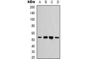 Western blot analysis of IFNGR1 expression in HEK293T (A), Hela (B), rat heart (C), rat brain (D) whole cell lysates. (IFNGR1 antibody)
