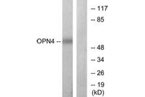 Western blot analysis of extracts from COLO cells, using OPN4 Antibody. (OPN4 antibody  (AA 429-478))