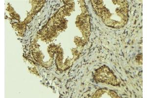 ABIN6276517 at 1/100 staining Mouse colon tissue by IHC-P. (BCL2L13 antibody  (Internal Region))
