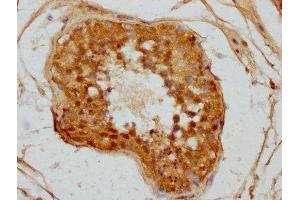 IHC image of ABIN7146980 diluted at 1:300 and staining in paraffin-embedded human testis tissue performed on a Leica BondTM system. (CTNNA3 antibody  (AA 163-302))