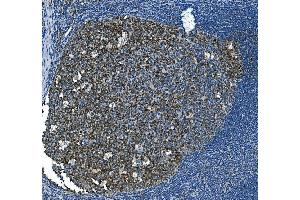 IHC analysis of MCM2 using anti-MCM2 antibody (ABIN7601594).