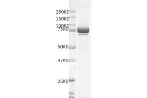 Recombinant SMYD4 protein gel. (SMYD4 Protein (DYKDDDDK Tag))