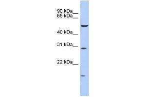WB Suggested Anti-HOXC5 Antibody Titration: 0. (Homeobox C5 antibody  (Middle Region))