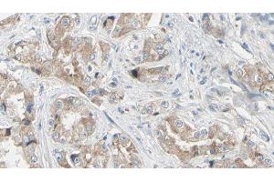ABIN6279343 at 1/100 staining Human prostate tissue by IHC-P. (NT5C2 antibody)