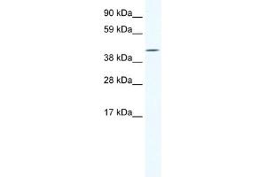 WB Suggested Anti-IRX6 Antibody Titration:  1. (IRX6 antibody  (C-Term))
