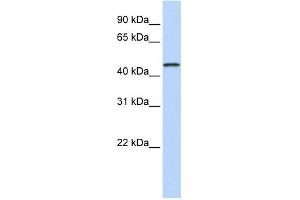 WB Suggested Anti-MAGEA10 Antibody Titration:  0. (MAGEA10 antibody  (Middle Region))