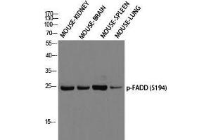 Western Blot (WB) analysis of Mouse Kidney Mouse Brain Mouse Spleen Mouse Lung using p-FADD (S194) antibody. (FADD antibody  (pSer194))