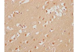 IHC image of ABIN7151483 diluted at 1:200 and staining in paraffin-embedded human brain tissue performed on a Leica BondTM system. (HuC/ELAVL3 antibody  (AA 1-367))