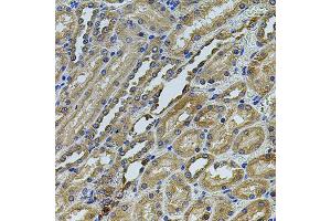 Immunohistochemistry of paraffin-embedded rat kidney using ANXA8L2 antibody (ABIN5975720) at dilution of 1/100 (40x lens). (ANXA8L2 antibody)