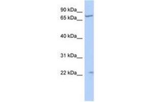 Image no. 1 for anti-Stimulated By Retinoic Acid 6 (STRA6) (N-Term) antibody (ABIN6741064) (STRA6 antibody  (N-Term))